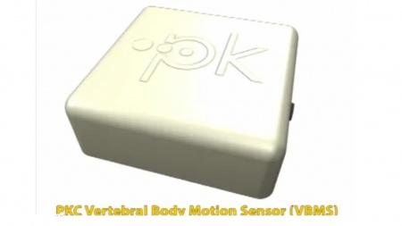 Vertebral Body Motion Sensor Overview